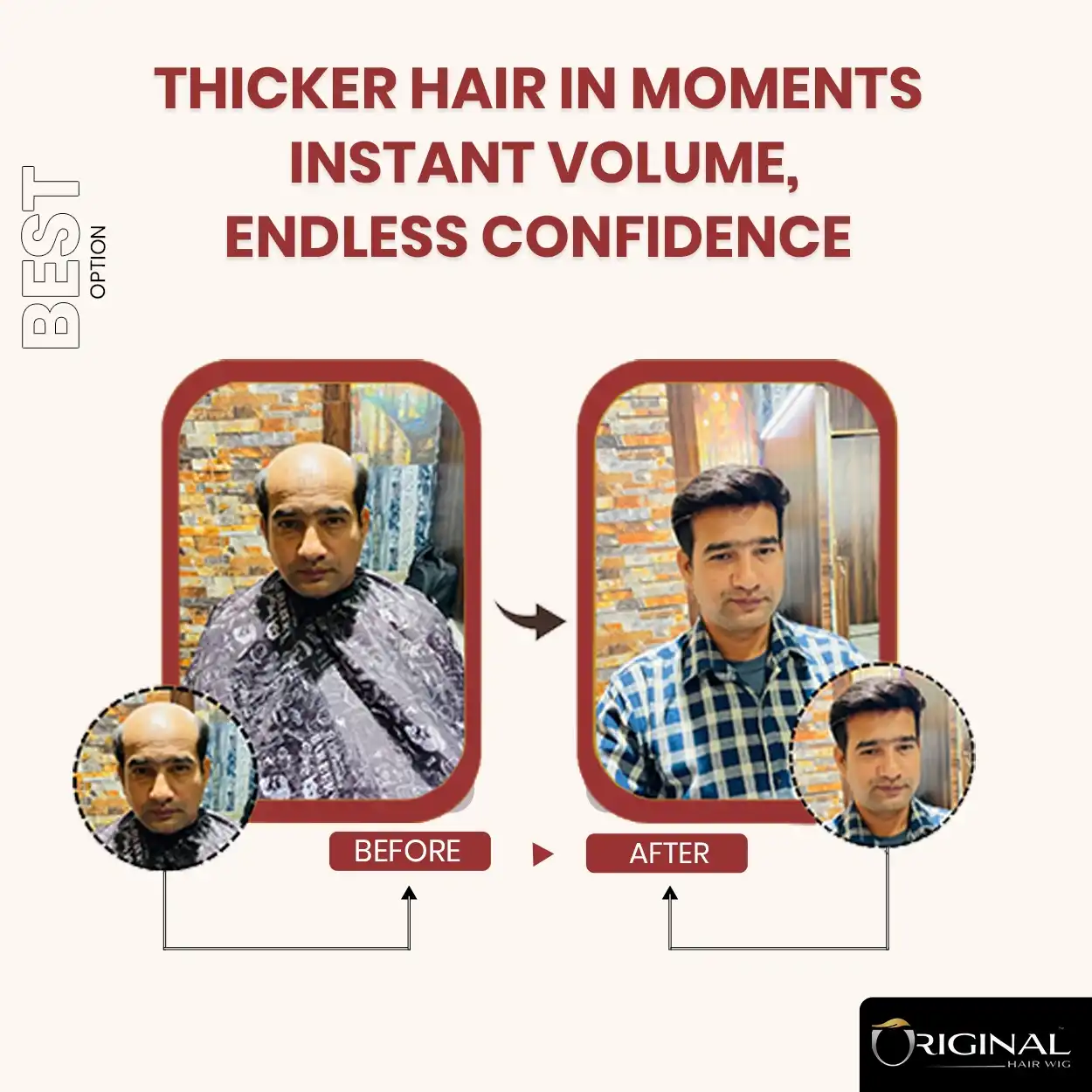 Natural Black Golden Australia Hair Patch Easy Fix with Tape Glue and Clips